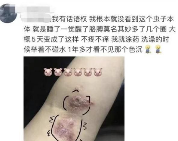 这种虫子毒液堪比硫酸图10