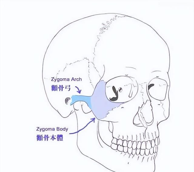 上海九院韦敏磨骨怎么样图4