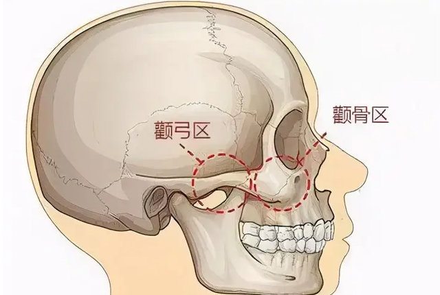 上海九院韦敏磨骨怎么样图6