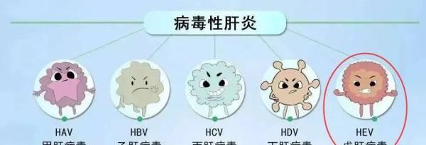 三个方法教你防治戊肝感染,戊肝治愈后还会再感染吗图1