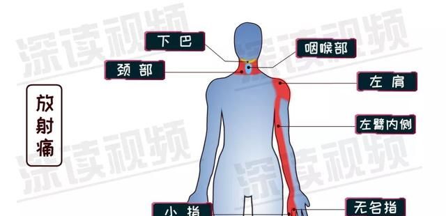 经常熬夜晚上胸痛是不是快猝死了图6