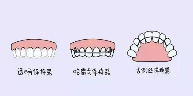 保持器大盘点图1