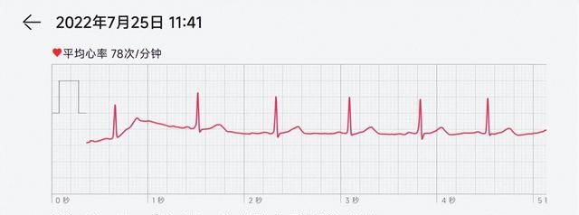 华为watch3pro ecg评测图10