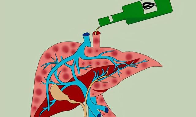 戒酒后肝脏能恢复健康吗,戒酒后多长时间肝脏能恢复正常图6