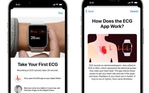 apple watch 心电图功能 大陆